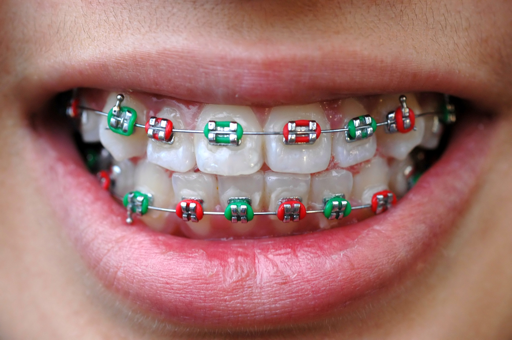 Z wizytą u ortodonty – zgryz u dzieci pod kontrolą