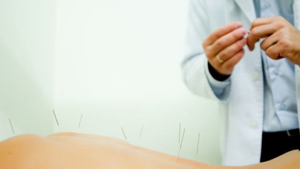 Akupunktura skutecznym lekiem w walce z napięciowym bólem głowy