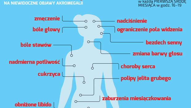 Akromegalia: jak rozpoznać chorobę?