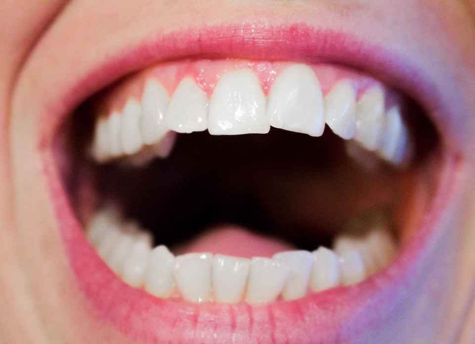 7 powodów, dla których nie należy ignorować krzywych zębów